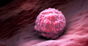 Descoberta vai aumentar eficiência de nanofármacos contra câncer