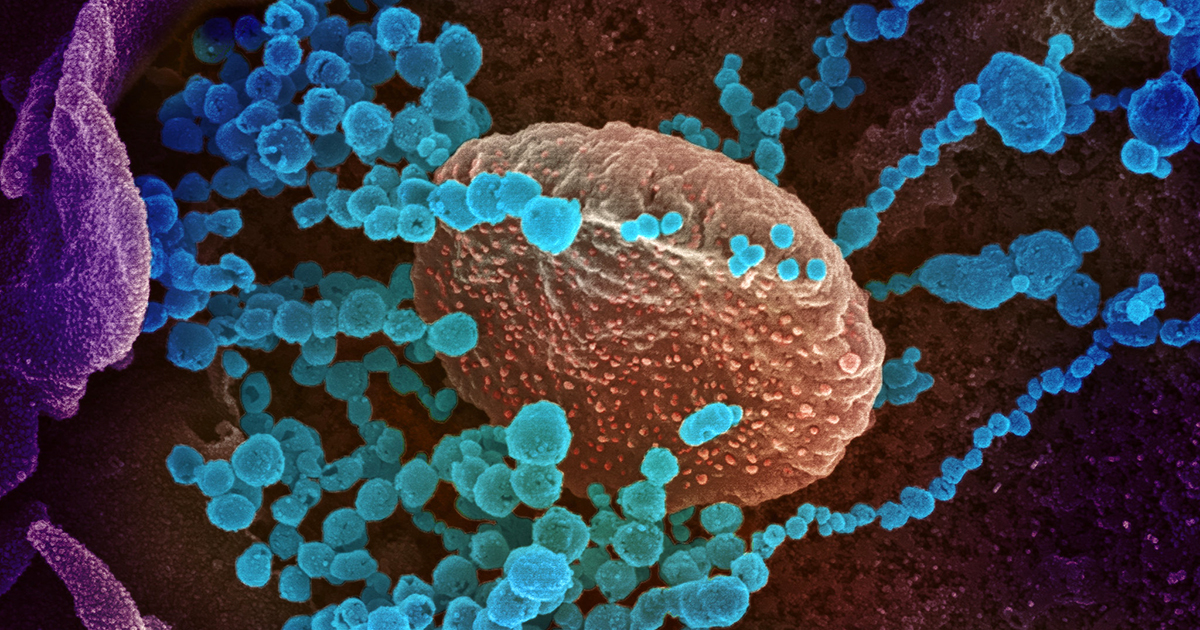 Novo Coronavírus SARS-CoV-2 - Foto: NIAD via Flickr (CC BY 2.0)