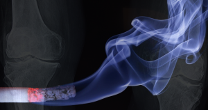 Fumaça de cigarro piora a qualidade do tecido ósseo, mostra estudo da Faculdade de Medicina