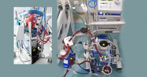 Tecnologias aprimoram tratamento de insuficiência respiratória por covid-19