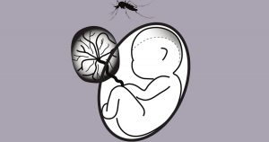 Estudo sugere marcador para diagnosticar pelo plasma microcefalia por zika em recém-nascido