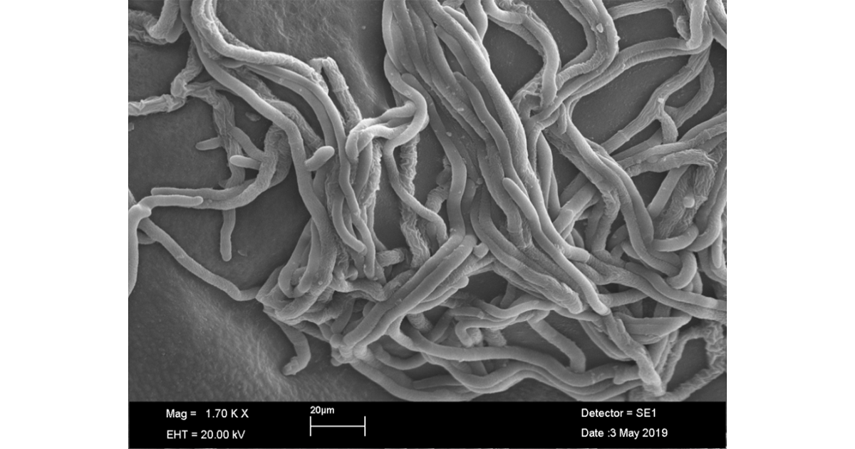 Microscopia: Fungo Rhizoctonia em modo axenico em placa de petri - Foto cedida pela pesquisadora
