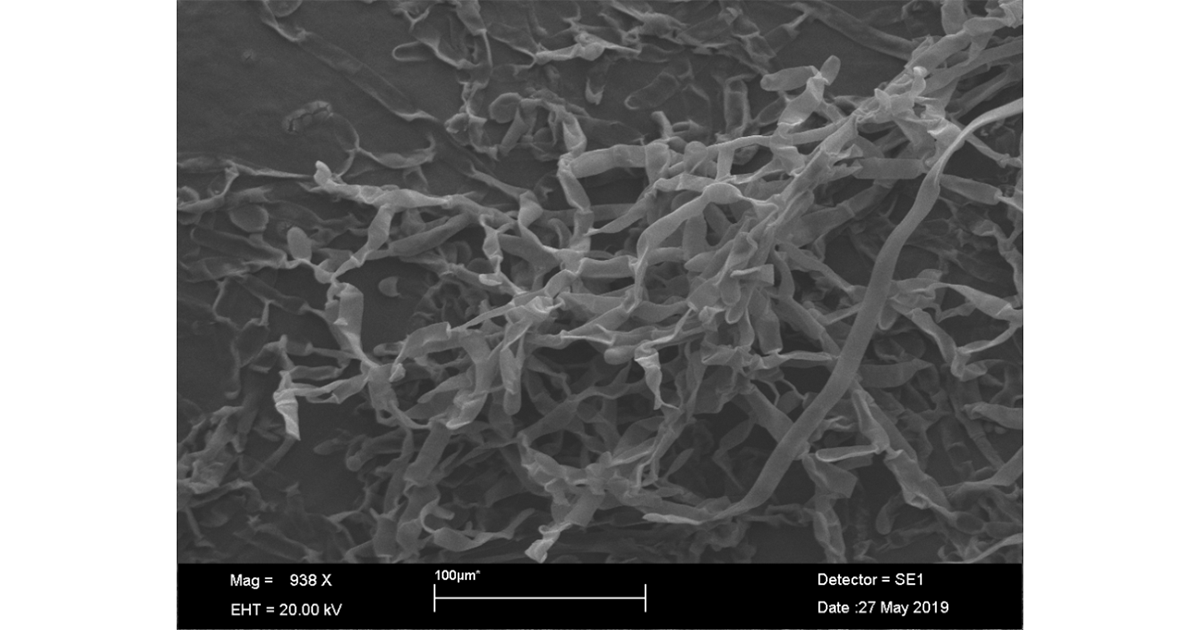 Microscopia: Fungo Rhizoctonia ao crescer com a actinobacteria na mesma placa - Foto cedida pela pesquisadora