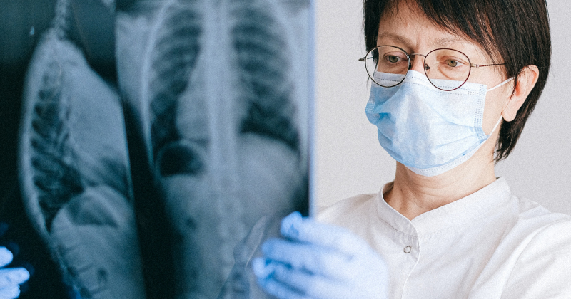 Radiografia pulmão