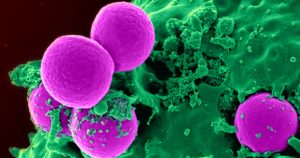 Bactérias benéficas para o corpo humano podem se modificar e tornar-se resistentes a antibióticos