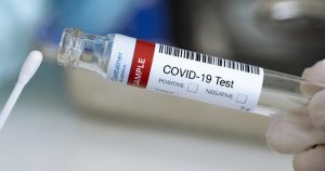 Plataforma Científica Pasteur-USP desenvolve testes para a detecção de anticorpos da covid-19