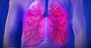 Taxa elevada de enzimas nos pulmões agrava casos de covid-19