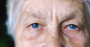 Queda da pálpebra superior dos olhos é doença que pode ser congênita ou adquirida