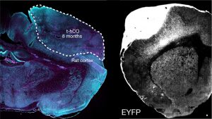 Para estudar doenças neurológicas, pesquisadores criam cérebro híbrido rato-humano