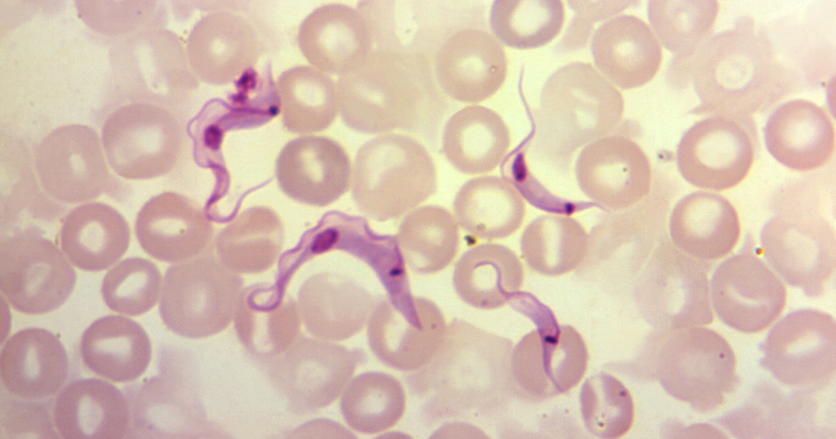 Quatro protozoários Trypanosoma cruzi numa amostra de sangue. Foto: Centers for Disease Control And Prevention Public Health Image Library
