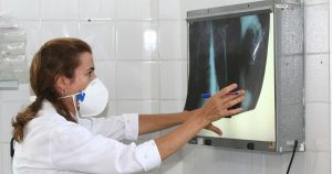 Tuberculose traz “custos catastróficos” para metade das famílias brasileiras afetadas