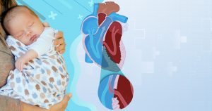 Cardiopatia congênita é frequente em bebês, mas não apresenta risco grave