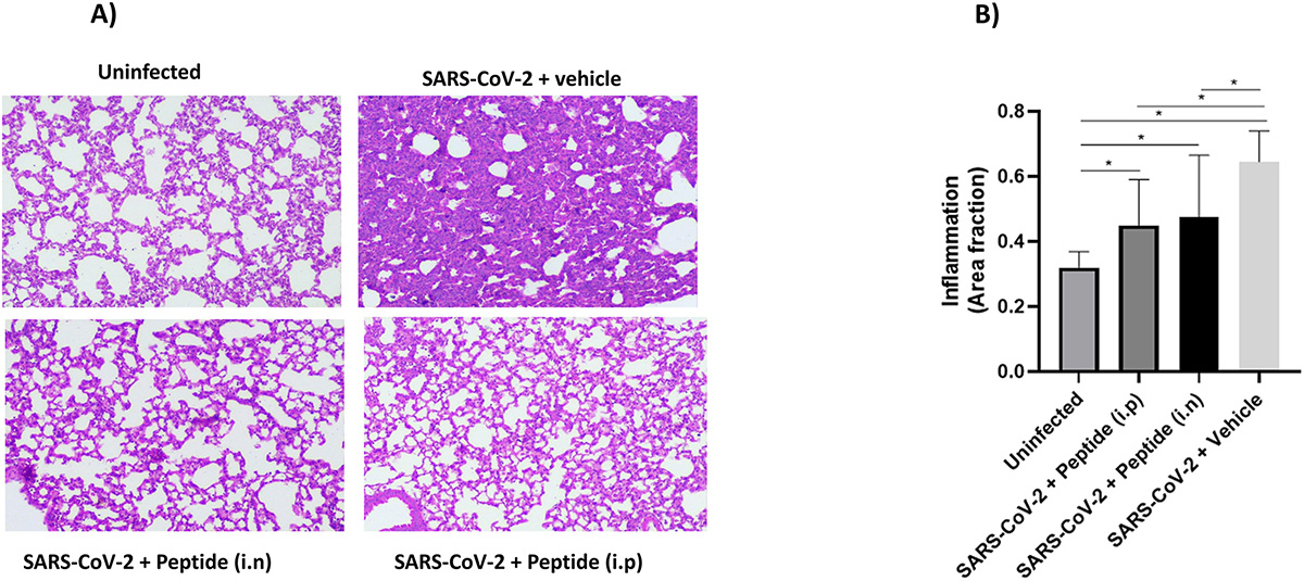 A imagem mostra é da histopatologia pulmonar de camundongos suscetíveis ao sars-cov- após tratamento intranasal com o peptídeo quimérico WT ACE2. Sãi quatro quadrados, em rosa, que mostra o incubação de partículasas virais de sars-cov-2 com ou sem o peptídeo WT ACE2 e aplicadas por via nasal em camundongos.