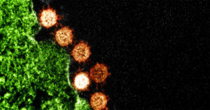 Micrografia eletrônica de transmissão colorida de partículas do vírus da Síndrome Respiratória Aguda Grave (SARS) (laranja) encontradas perto da periferia de uma célula infectada (verde).