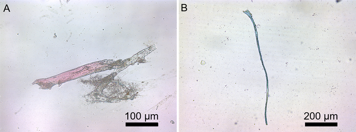 Duas imagens de microscópio com fibras de plástico encontradas em animais marinhos. São rosa e cinza