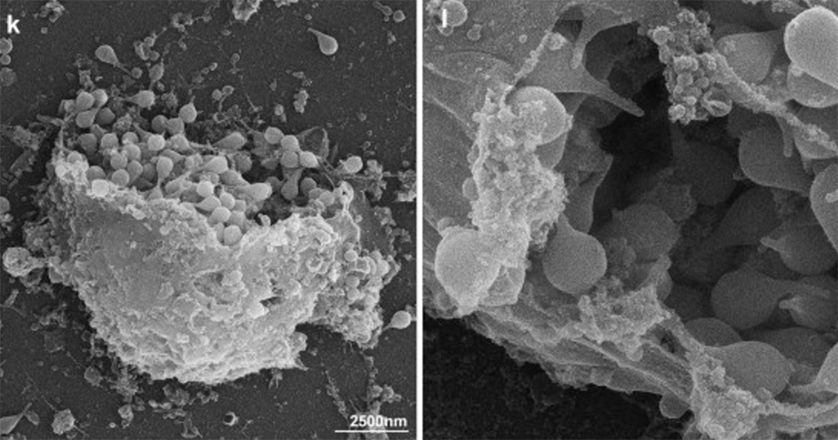 Resultado obtido por microscopia eletrônica de varredura (MEV) de células infectadas pelo Naiavirus após lise.