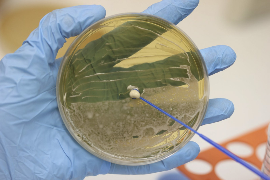 A imagem mostra uma mão com luvas azuis de laboratório segurando uma placa redonda contendo meio de cultura de cor amarelada. Um bastão de inoculação azul toca uma colônia arredondada de cor clara localizada mais ao centro da placa. O ambiente ao redor é claramente laboratorial, com fundo desfocado em tons claros.