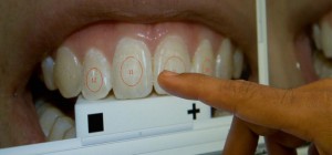 Dentista hospitalar melhora assistência ao paciente com câncer